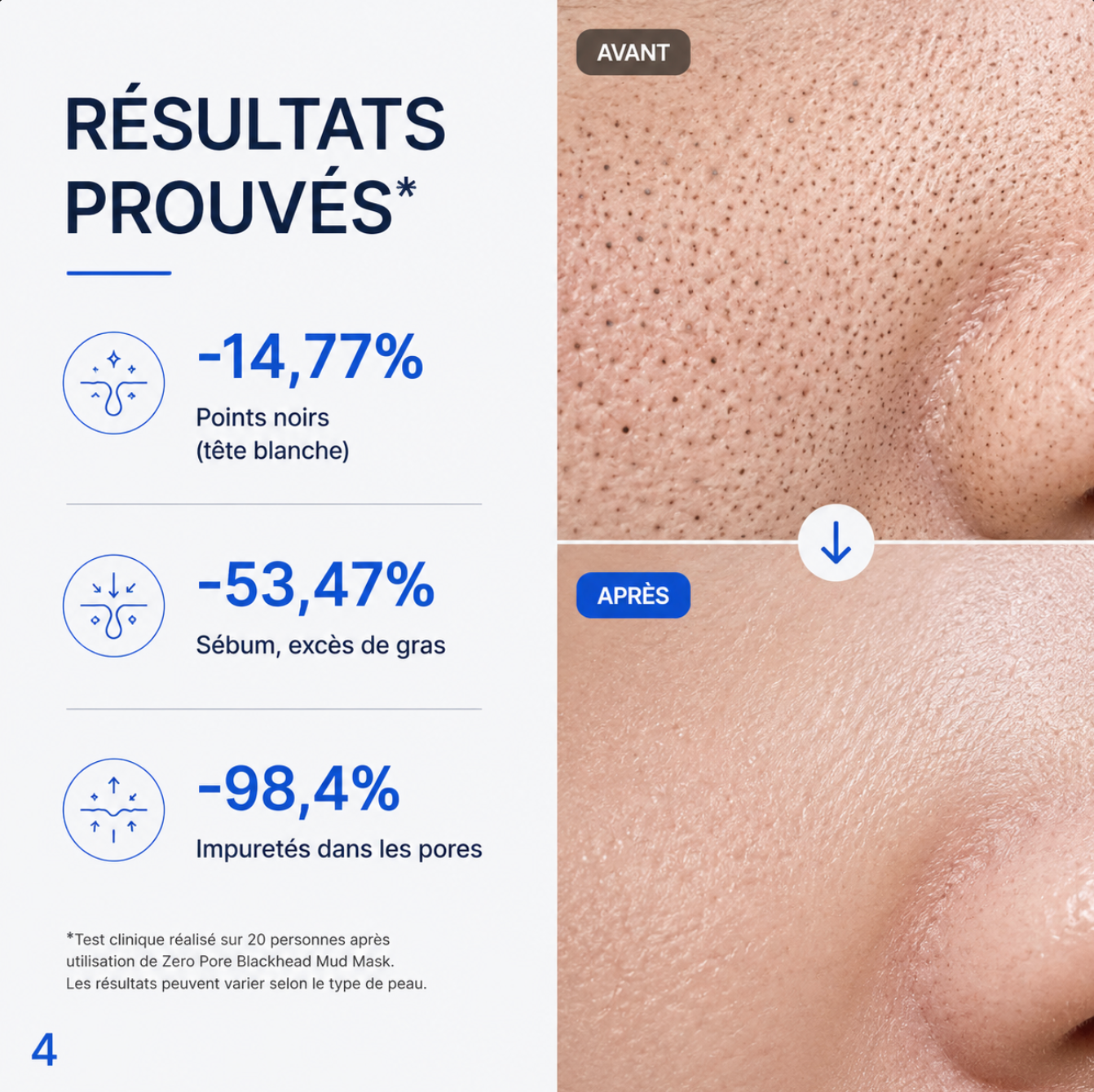 Medicube Blackheads™