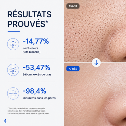 Medicube Blackheads™